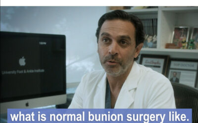 When can I walk on my foot after the miniBunion procedure?